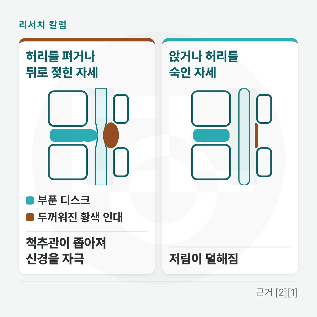 허리뼈 옆모습 선 그림 두 칸 — 왼쪽 「허리를 펴거나 뒤로 젖힌 자세: 척추관이 좁아져 신경을 자극」, 오른쪽 「앉거나 허리를 숙인 자세: 저림이 덜해짐」, 왼쪽 그림에 「부푼 디스크」 「두꺼워진 황색 인대」 표시를 둔 그림